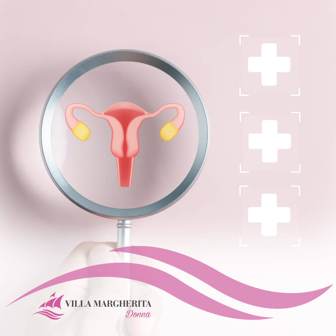 Ciclo anovulatorio