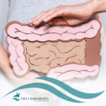 Cosa Sono i Diverticoli del Colon e Quando Preoccuparsi