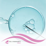 Pick up ovocitario: come si svolge e a cosa serve