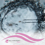 PMA (Procreazione Medicalmente Assistita): pro e contro che devi conoscere