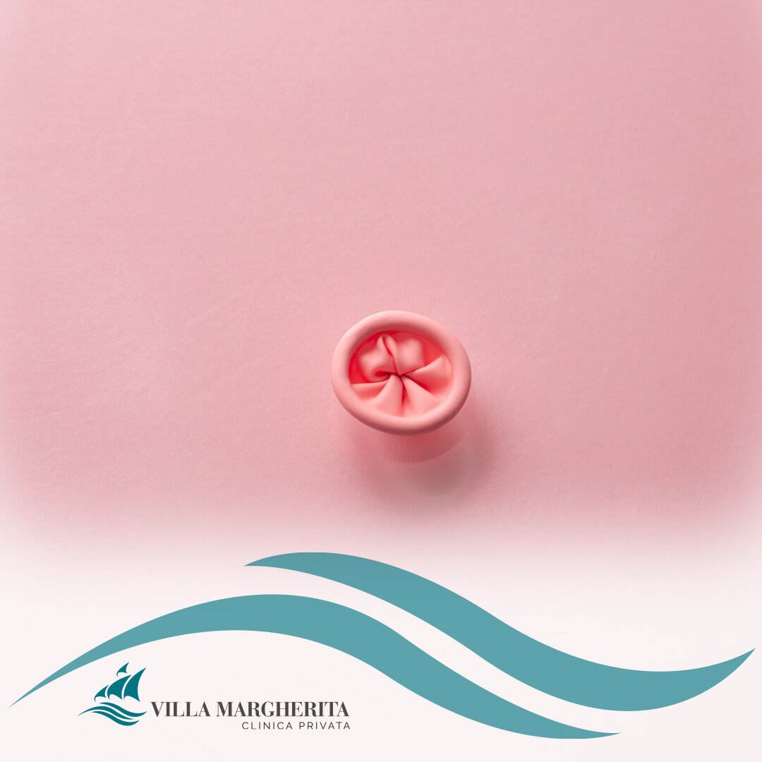 prolasso-rettale-blog