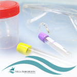 Sangue Occulto nelle Feci: Perché Servono 3 Campioni?